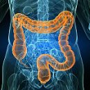 intestinal dysbiosis symptoms diagnosis and treatment