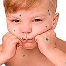 infectious diseases in children that you need to know
