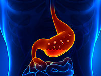 Sintomas de úlceras estomacais