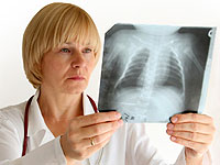 Fördelningen av kronisk bronkit
