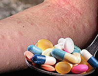 drug allergy symptoms and treatment