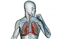Typer och former av lunginflammation