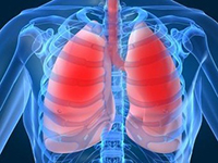 Sintomas de bronquite