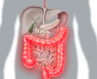 Maladie de Crohn: Symptômes et traitement