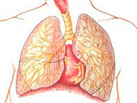 Enfermedad bronquiectática: Clasificación