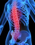What is dangerous osteoarthrosis of the spine?