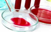 Doença de Poklush, títulos de anticorpos no sangue