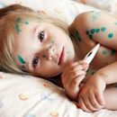 child sick with chickenpox what to do