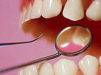 Causas de formação dentária em Huma