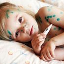 Chickenpox symptoms and treatment of the most common childhood infection