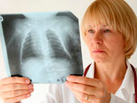 Informazioni sulla clinica ascesa del polmone