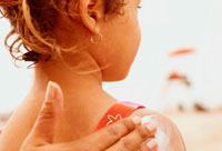 Burnas soleadas en niños: Cómo advertir y luchar