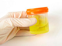 L'analisi delle urine con urolitiasi dovrebbe essere sotto il controllo rigoroso