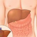 diffuse liver changes