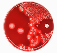 Infecção de Staphylococcus em crianças