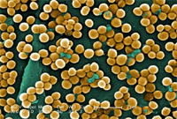 Staphylococcus what we know about aureus