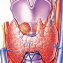 complications after thyroidectomy