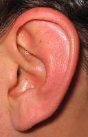 Vícios de desenvolvimento de ouvido congênito