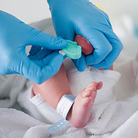 Техника за вземане на капилярна кръв от новородени