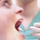 pulpitis treatment of patients teeth