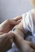 Морбили: лечение и ваксинация