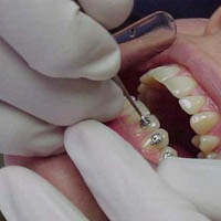 Wir behandeln Anfälle beim ... Zahnarzt