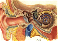 Trys otosklerozės formos