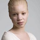 living with albinism, or the most charming and attractive