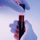 the value of the main indicators of total blood analysis