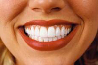 As principais direções da prevenção de cárie dos dentes