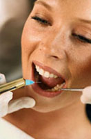 Заптивање зуба и материјала за бртвљење