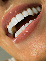 Избелване на зъбите