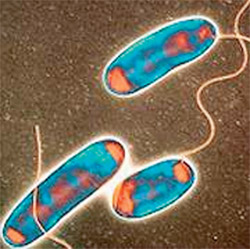 legionellosis or insidious bacterium