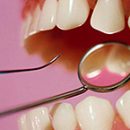 types of periodontitis