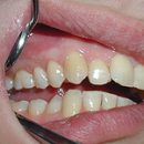 What is periodontal