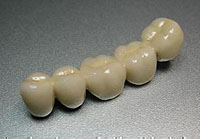 Tooth crown or crown for teeth