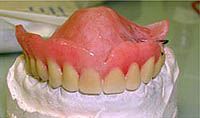 Vista moderna de las dentaduras