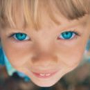 who can develop strabismus