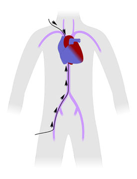 Diagnostic de défauts cardiaques congénitaux