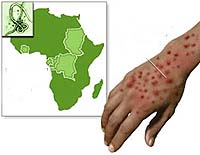 Febres especialmente perigosos de Ebola e Marburg