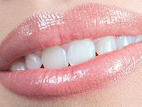 7 regler för att undvika karies och periodontit